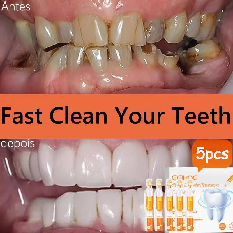 Teeth Whitening Baking Soda - 치약 세럼으로 빠르게 치아 주위 조직