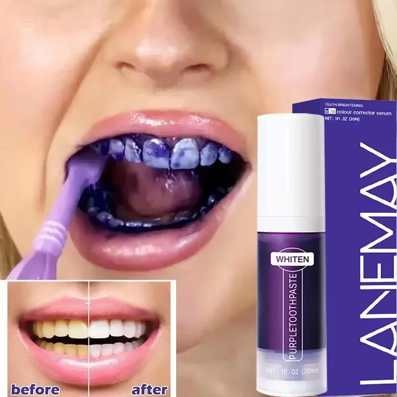 Teeth Whitening Crest - V34 보라색 치아 미백 치약 플라크