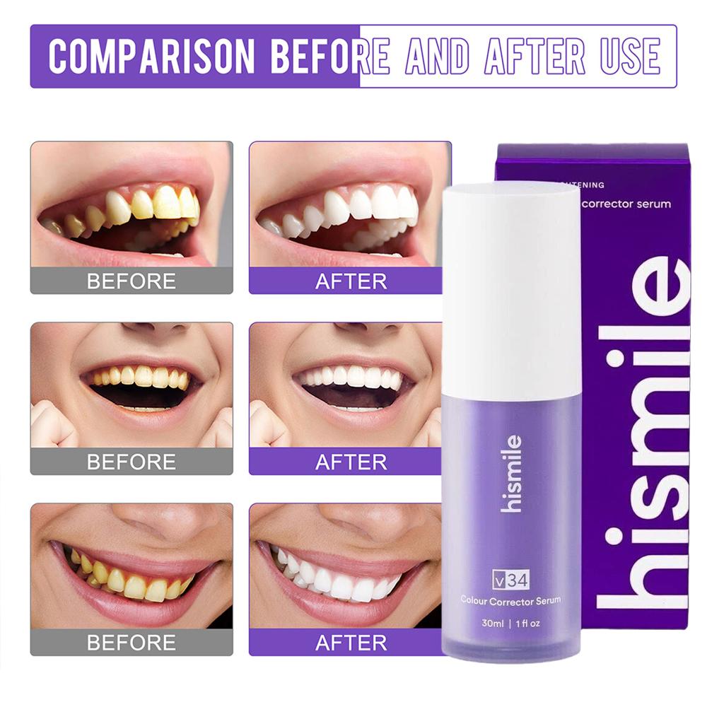 Teeth Whitening Crest - 30ml 히스마일 V34 퍼플 치아 미백