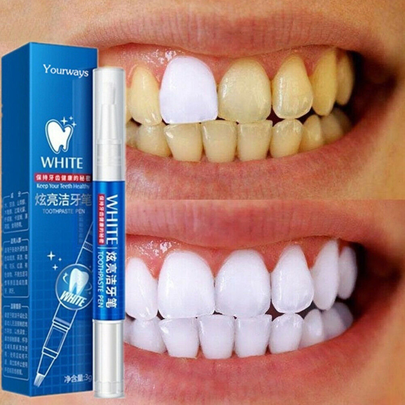 치아 미백 젤, 얼룩 제거제, 치아 미백 젤 펜, 구강 - Teeth Whitening Gel Pen 리뷰 및 가격