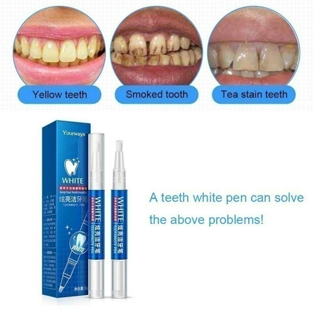 치아 미백 젤, 얼룩 제거제, 치아 미백 젤 펜, 구강 - Teeth Whitening Gel Pen 리뷰 및 가격