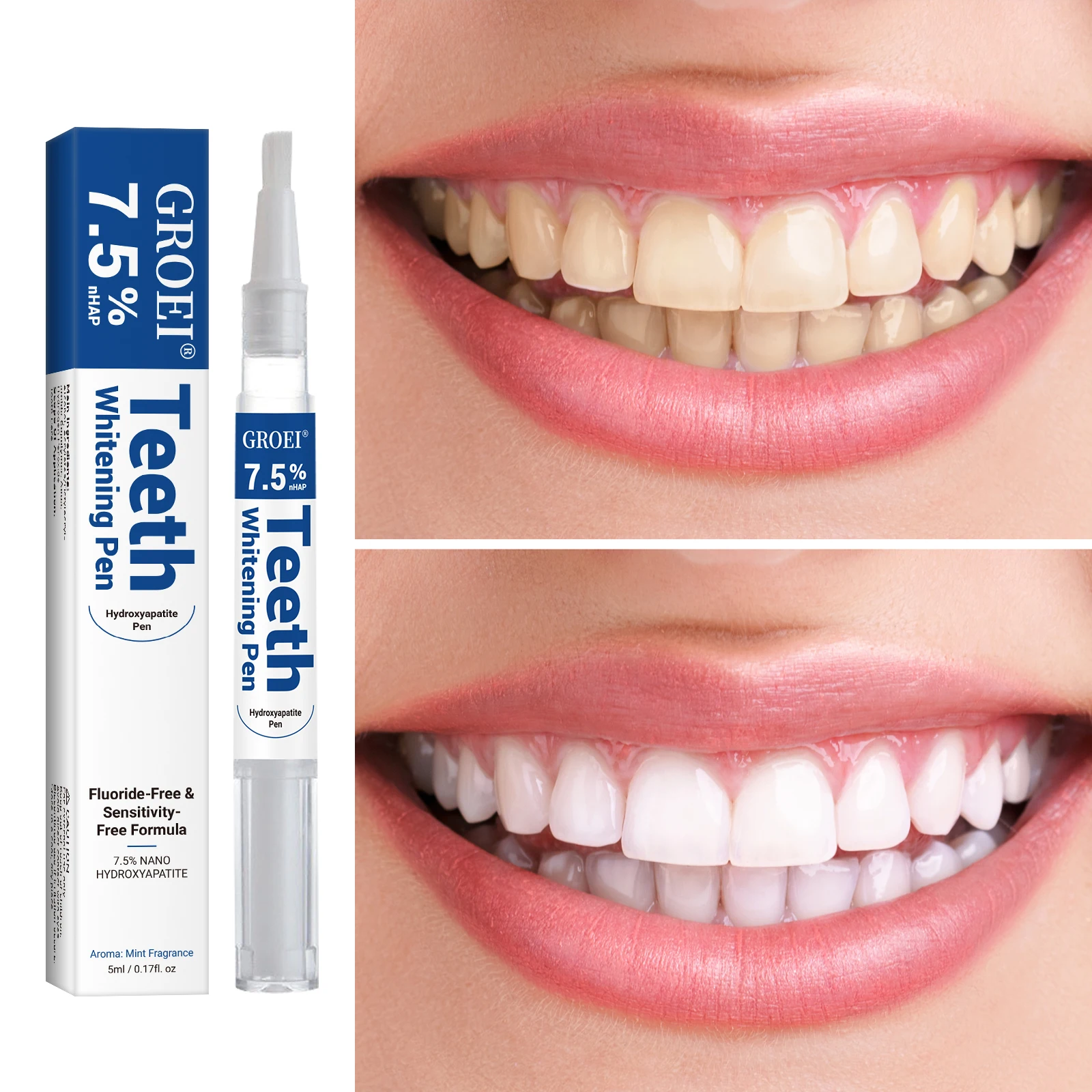 하이드록시아파타이트 치아 미백 펜 눈부신 화이트 얼룩  - Teeth Whitening Gels 리뷰 및 가격
