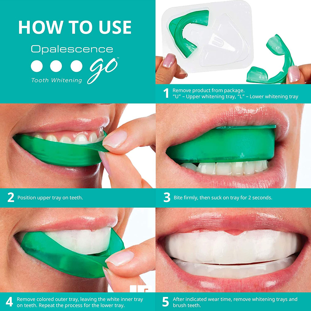 치아 미백용 과산화 수소, 유백광 고 프리필 트레이,  - Teeth Whitening Hydrogen Peroxide 리뷰 및 가격