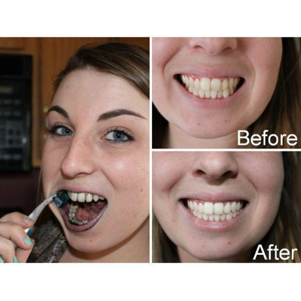 대나무 숯 치아 치아 Dentis Lab 구강 위생 관 - Teeth Whitening Charcoal Powder 리뷰 및 가격