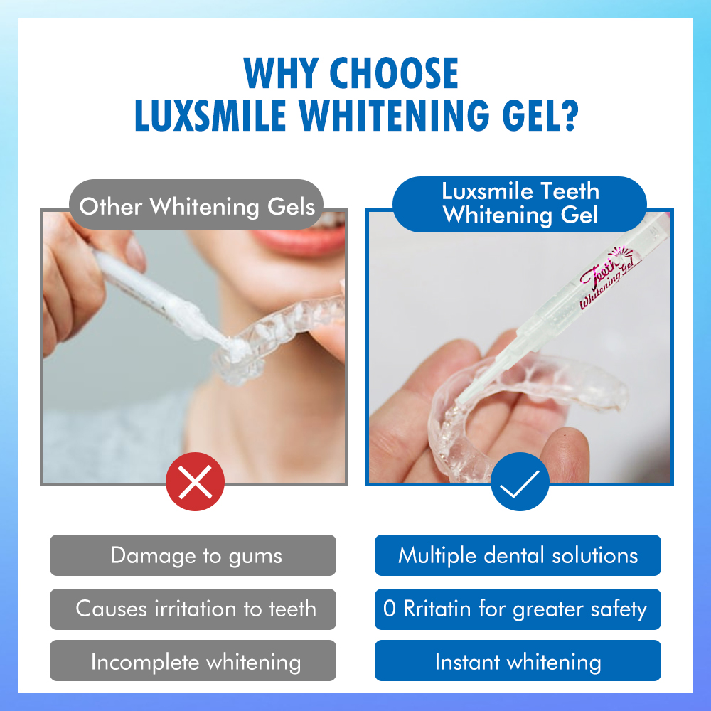 치아 미백 젤 PAP 또는 35%CP 치아 미백 젤 구 - Teeth Whitening Gels 리뷰 및 가격