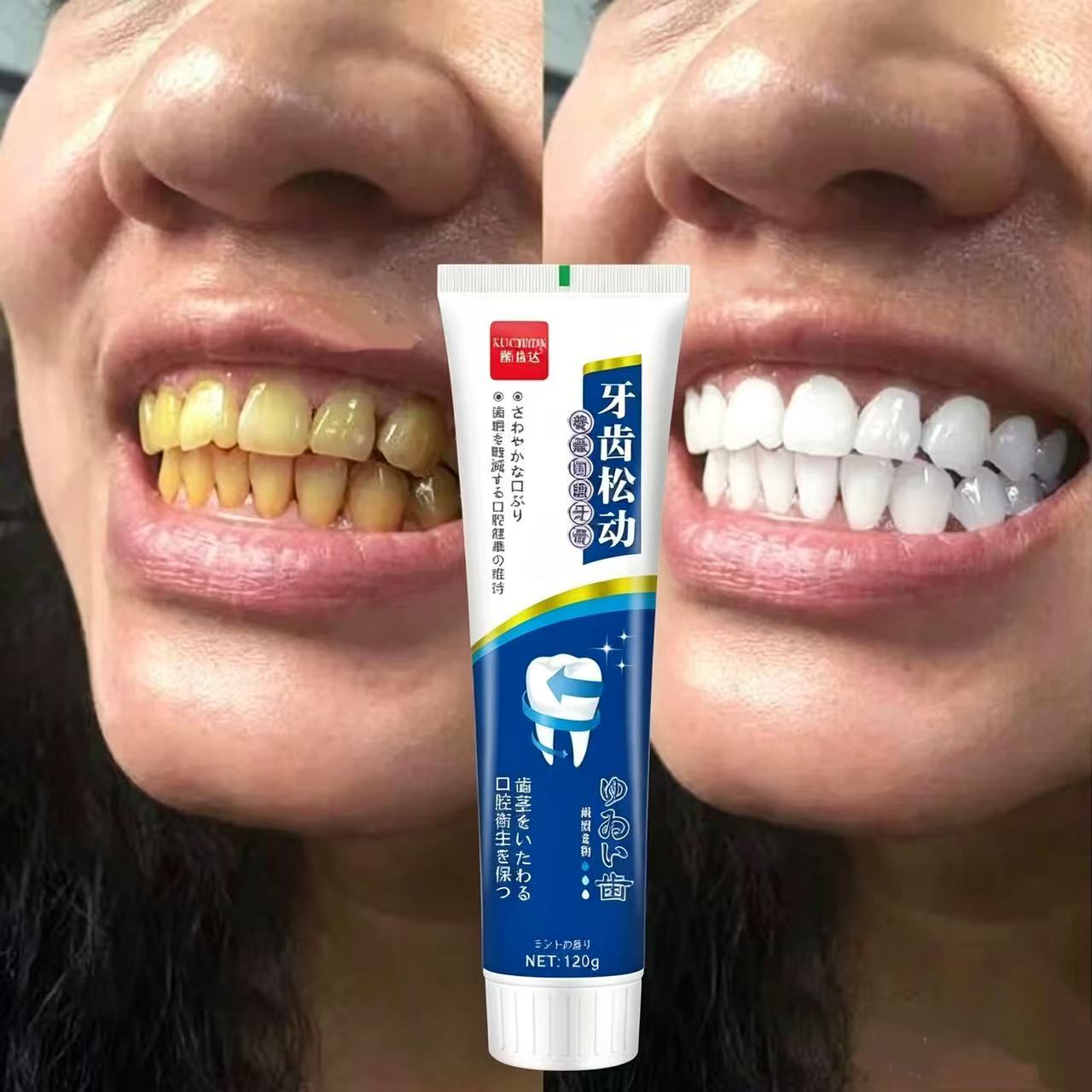 느슨한 치아를 고치는 일본 수입 치약, 성인용 연중 구 - Teeth Whitening Japan 리뷰 및 가격