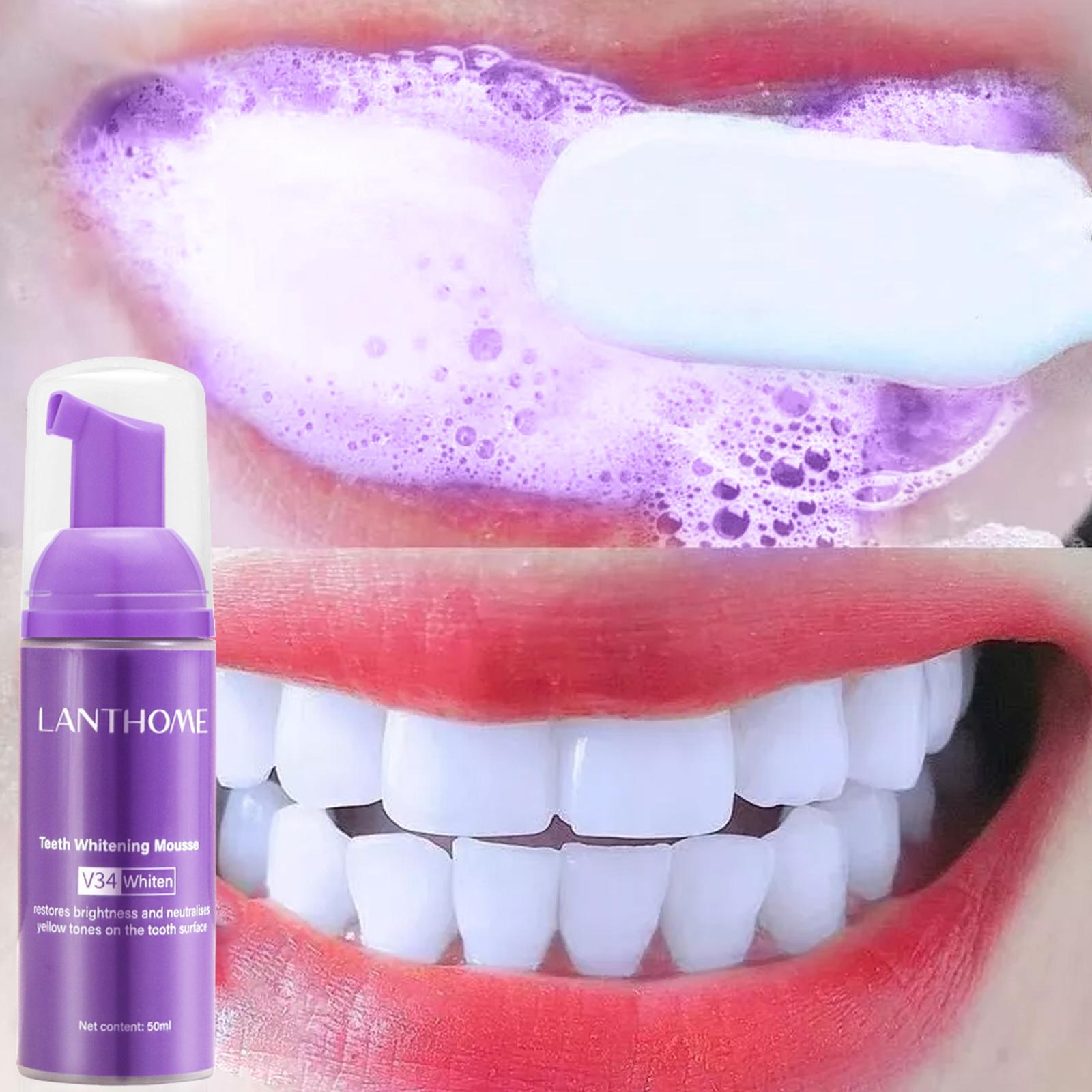 V34 무스 치아 청소 치약 효과적인 브라이트닝 치아  - Teeth Whitening Crest 리뷰 및 가격