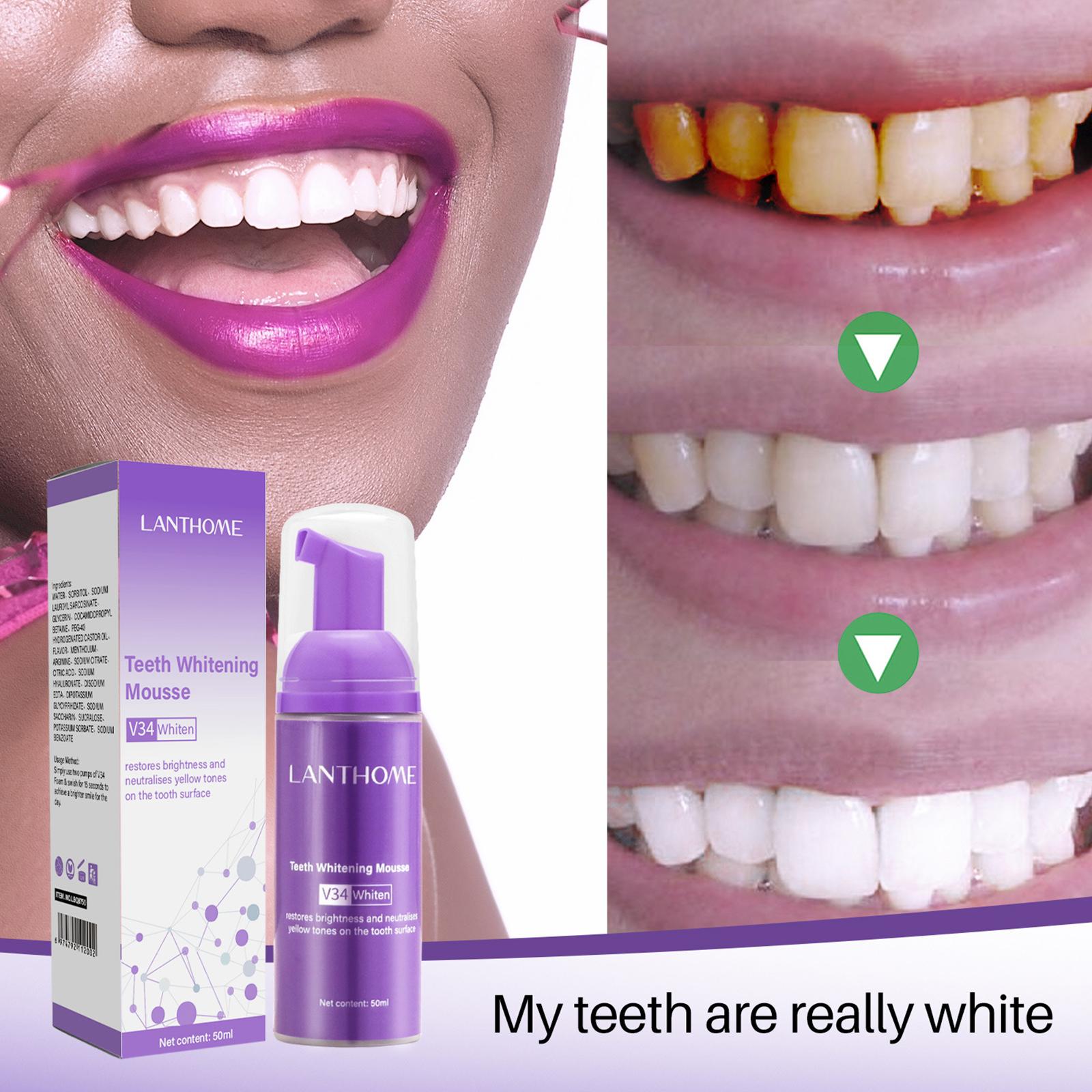 V34 무스 치아 청소 치약 효과적인 브라이트닝 치아  - Teeth Whitening Crest 리뷰 및 가격