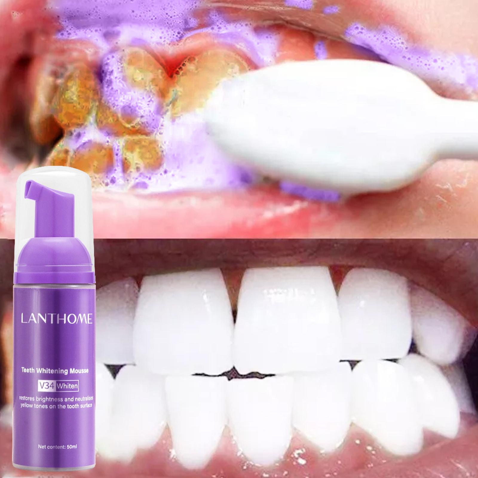 V34 무스 치아 청소 치약 효과적인 브라이트닝 치아  - Teeth Whitening Crest 리뷰 및 가격