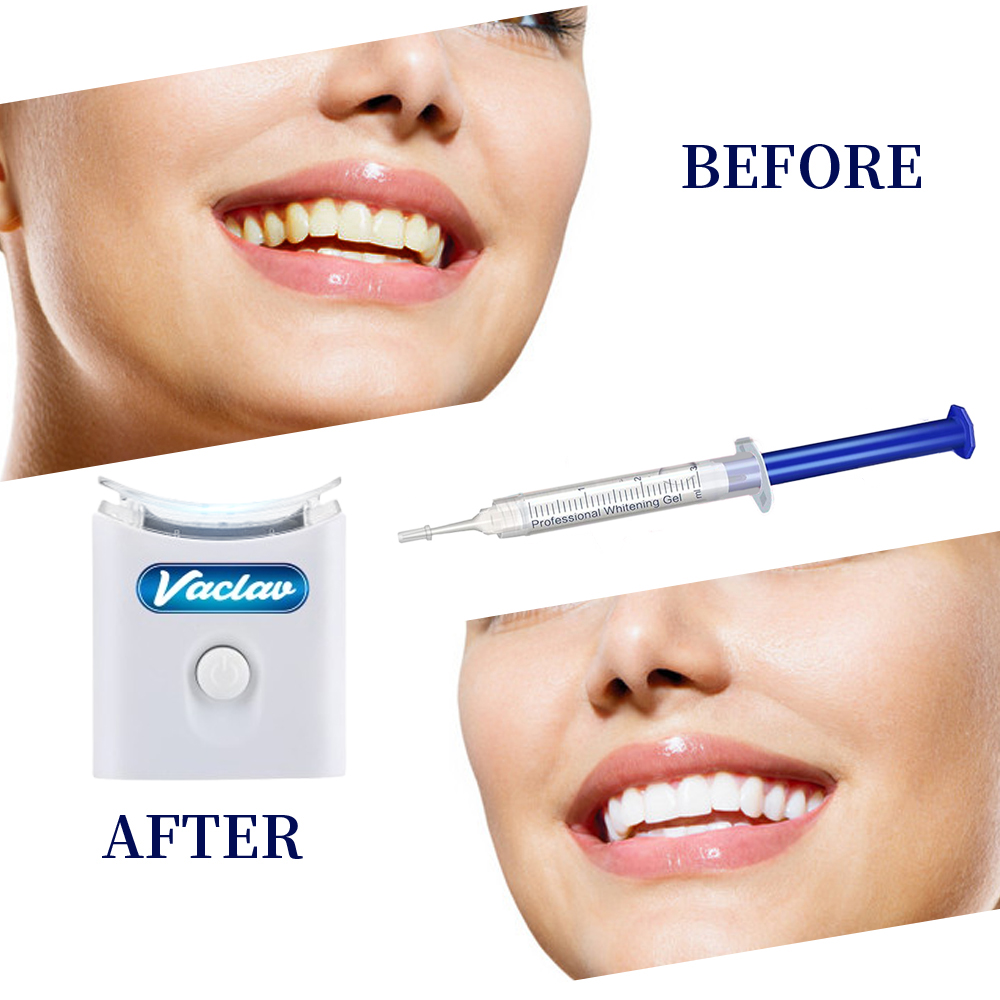 민트 치아 미백 젤 주사기 가정용 치아 미백 키트 LE - Teeth Whitening Baking Soda 리뷰 및 가격