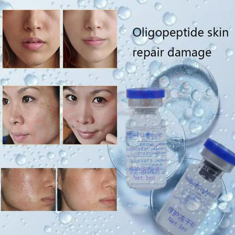 팩토리 8바이알 올리고펩타이드 펩타이드 동결건조 파우더 - Whitening Powder Activated 리뷰 및 가격