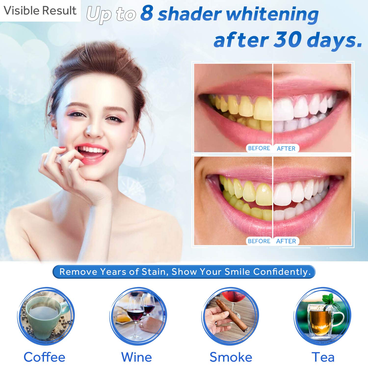 치아 미백 젤 리필 주사기 치아 미백 젤 인비스알라인  - Teeth Whitening Gels 리뷰 및 가격