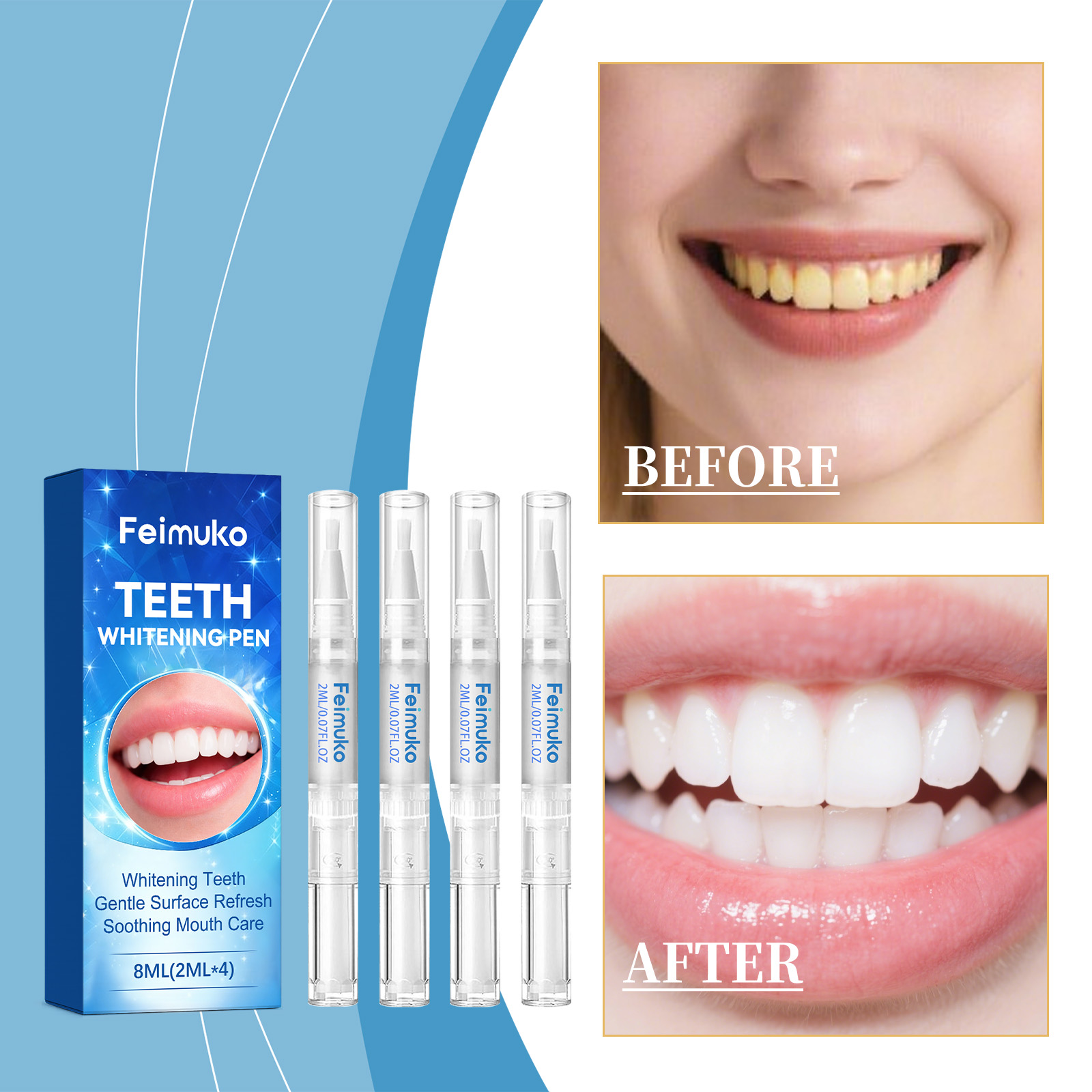 페이무코 8ml 치아 젤 펜 순한 딥 클린 광택 치아  - Teeth Whitening Gel Pen 리뷰 및 가격