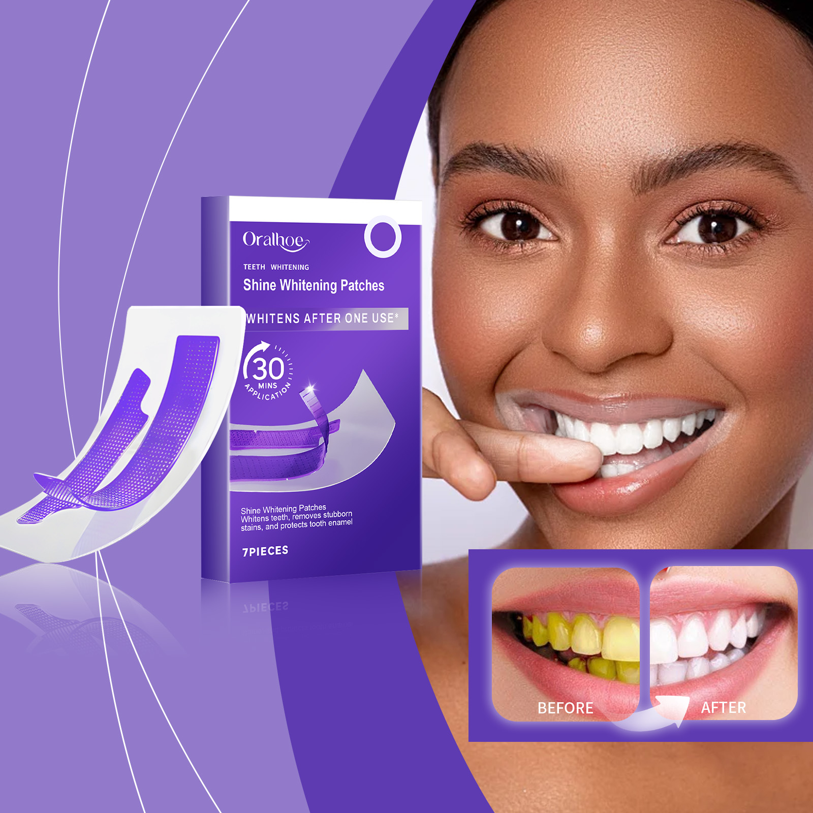 보라색 치아 미백 스트립 – 플라크 및 얼룩 제거, 치 - Teeth Whitening Flash 리뷰 및 가격