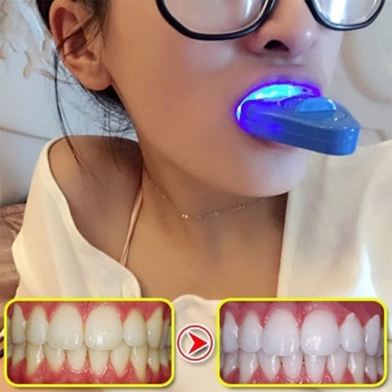 LED 치아 미백 라이트 미백 블루 라이트 UV 라이트 - Teeth Whitening Uv Kit 리뷰 및 가격