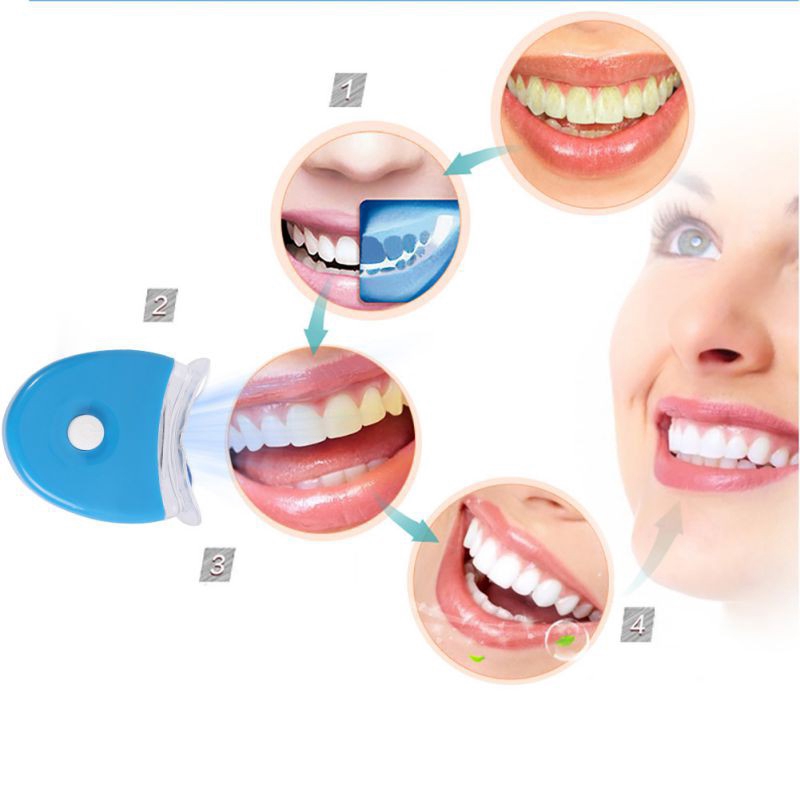 LED 치아 미백 라이트 미백 블루 라이트 UV 라이트 - Teeth Whitening Uv Kit 리뷰 및 가격