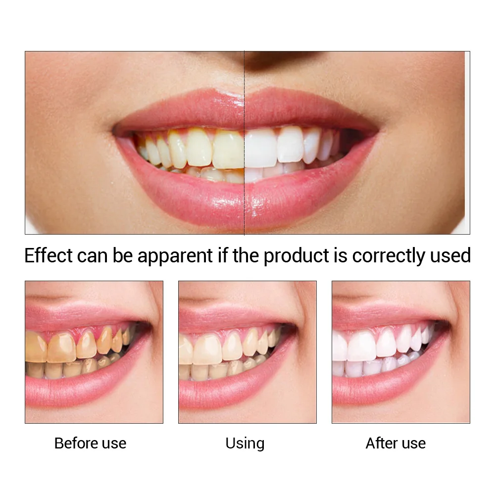 FTEENPLY 치아 미백 에센스 파우더 구강 위생 청 - Teeth Whitening Paste 리뷰 및 가격
