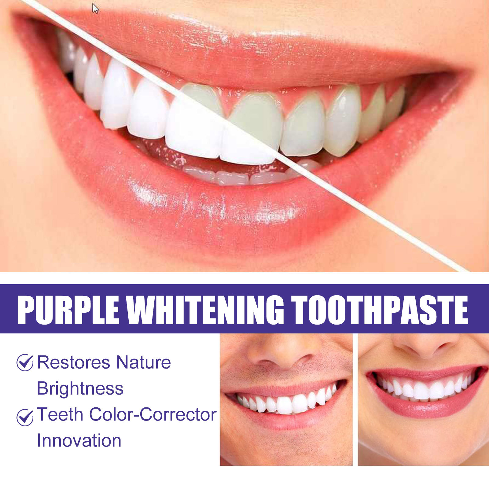 퍼플 치약 치아 미백 황색 얼룩 제거 치석 제거 상쾌한 - Teeth Whitening Crest 리뷰 및 가격