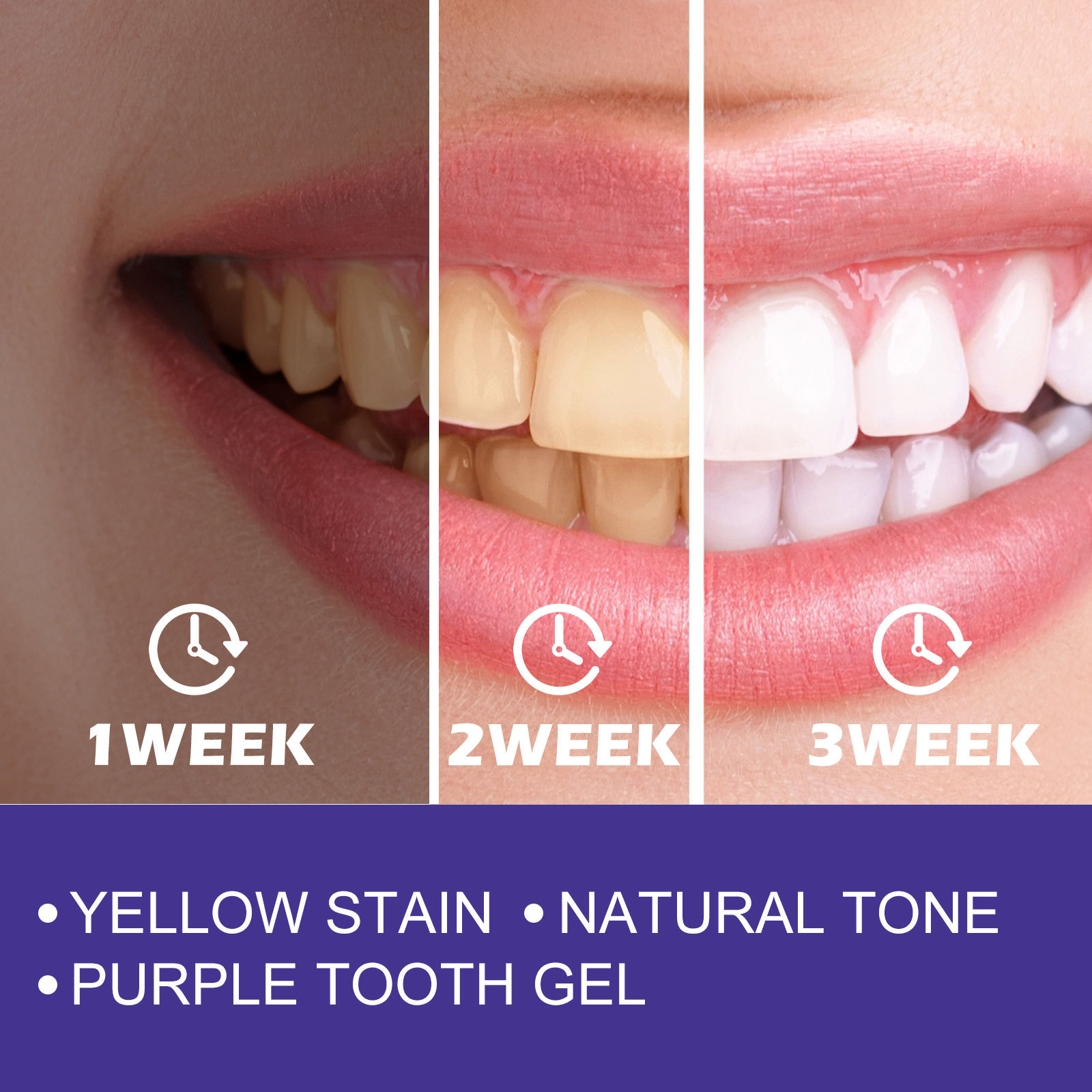 퍼플 치약 치아 미백 황색 얼룩 제거 치석 제거 상쾌한 - Teeth Whitening Crest 리뷰 및 가격