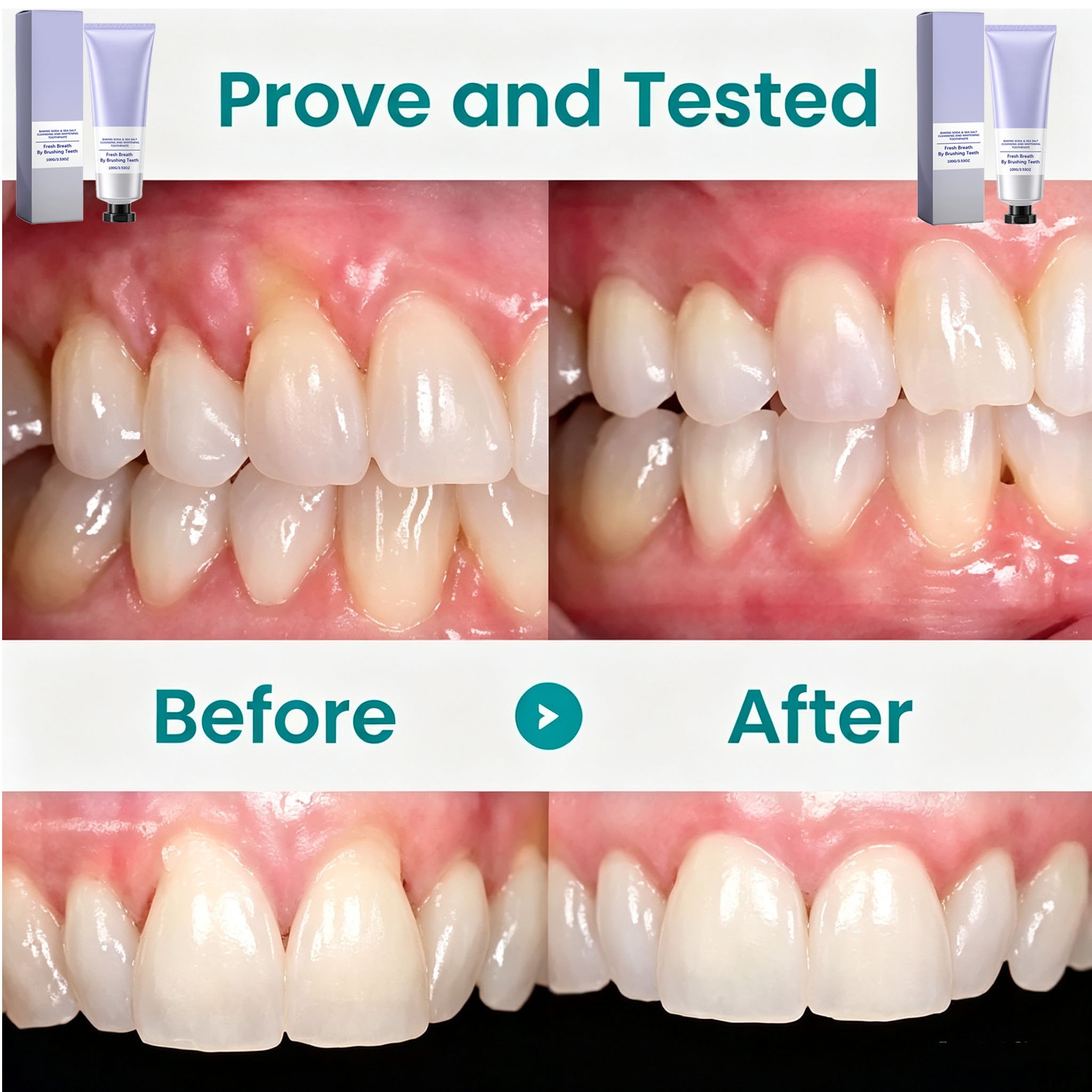 베이킹소다 & 해염 치약, 딥 클렌징, 치아 미백, 상 - Teeth Whitening Baking Soda 리뷰 및 가격