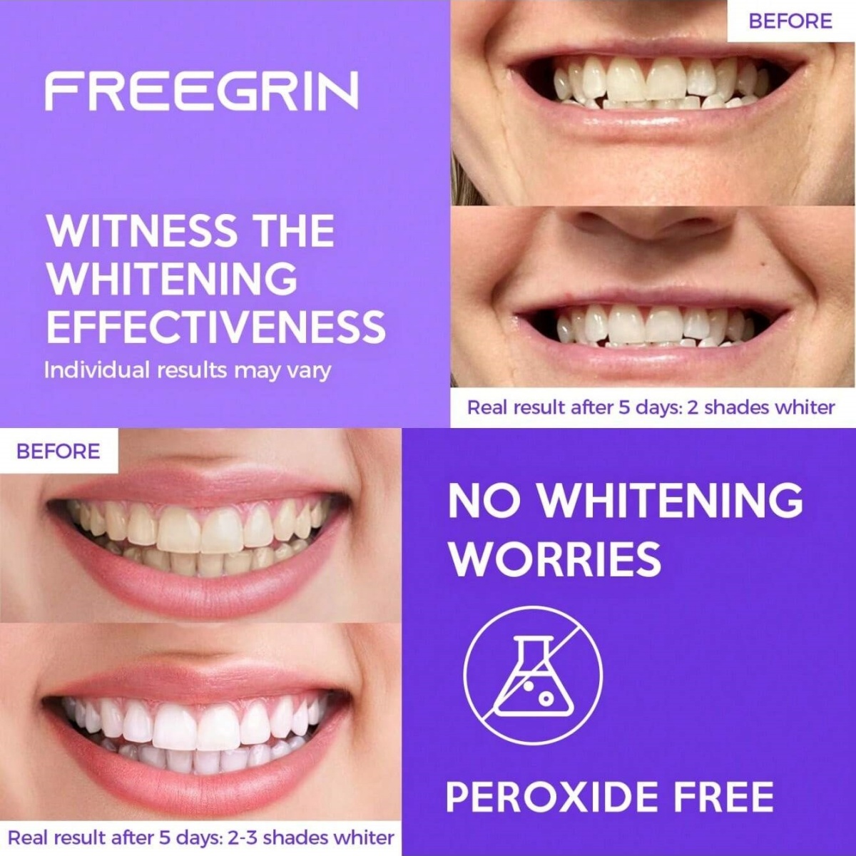 디럭스 화이트닝 치아 스티커 7/14/21 쌍 젤 화이 - Teeth Whitening Hydrogen Peroxide 리뷰 및 가격