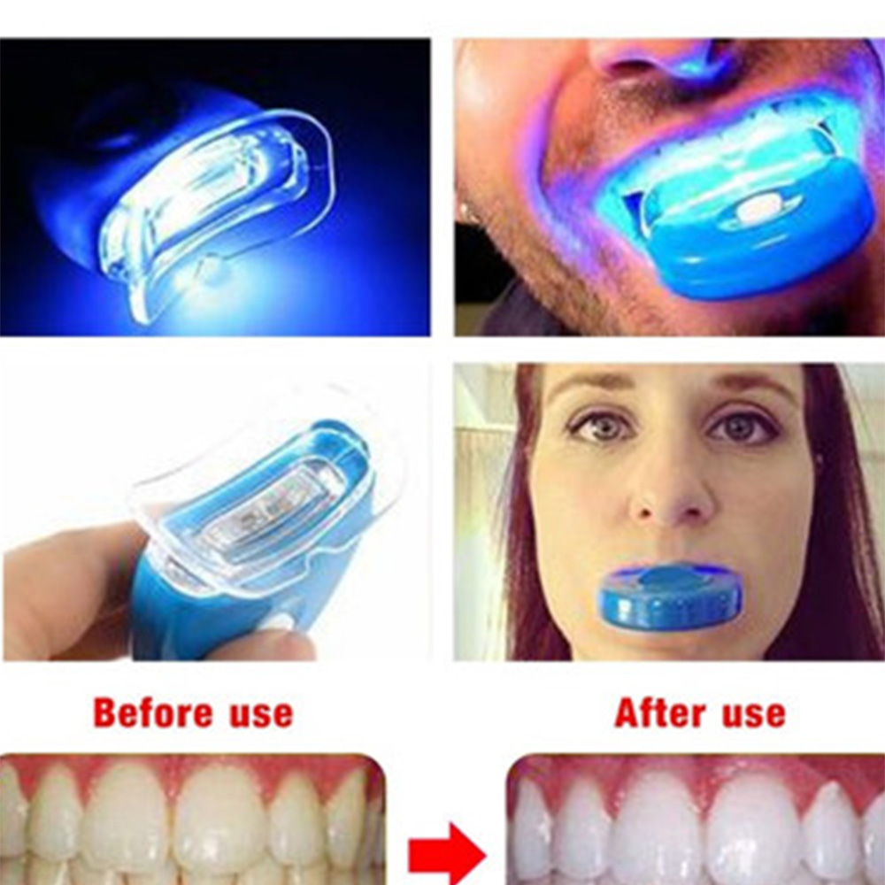 블루 LED 치아 미백 가속기, UV 라이트 치과 레이 - Teeth Whitening Uv Kit 리뷰 및 가격