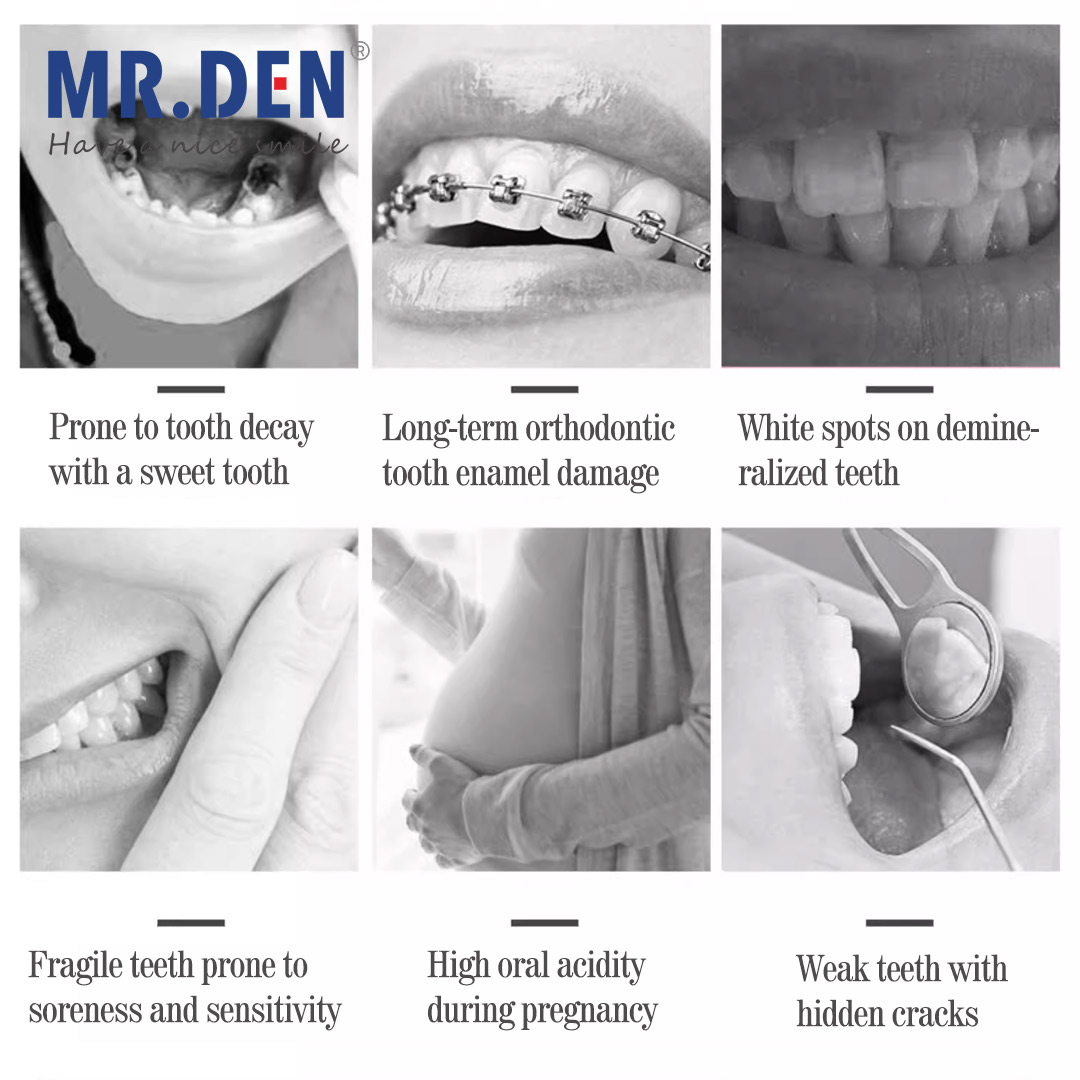 일본 GC 불소 강화 치과 치료, 비불소 치과 치료,  - Teeth Whitening Japan 리뷰 및 가격
