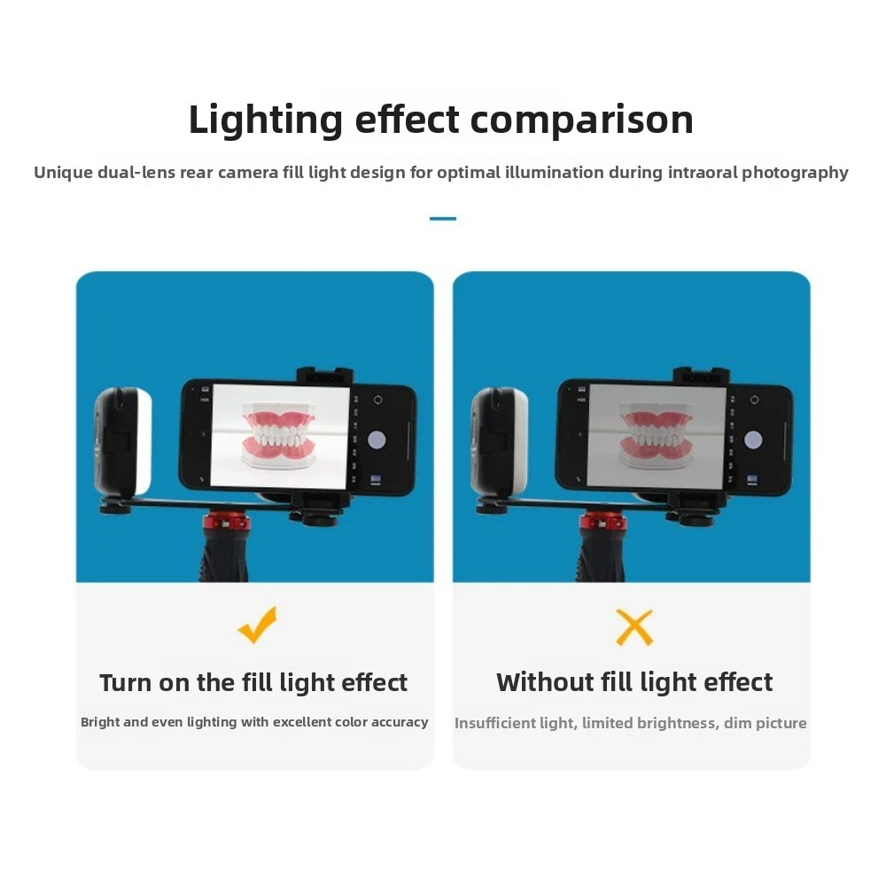 치과 사진 촬영 조명, 스마트폰용 블루투스 LED 플래 - Teeth Whitening Flash 리뷰 및 가격