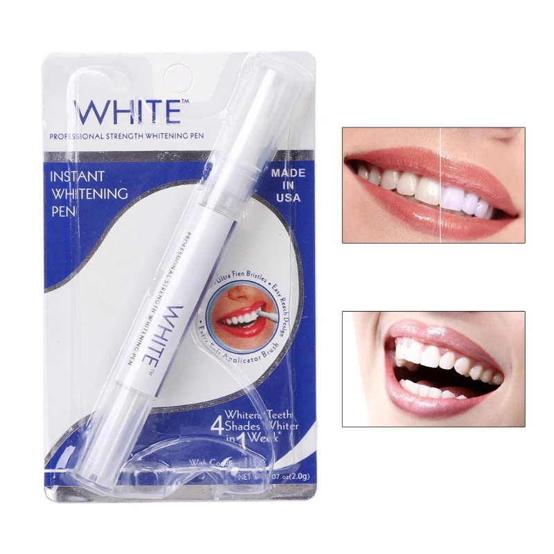 인스턴트 화이트 치아 미백 펜, 사용하기 쉬운 치아 표 - Teeth Whitening Gel Pen 리뷰 및 가격