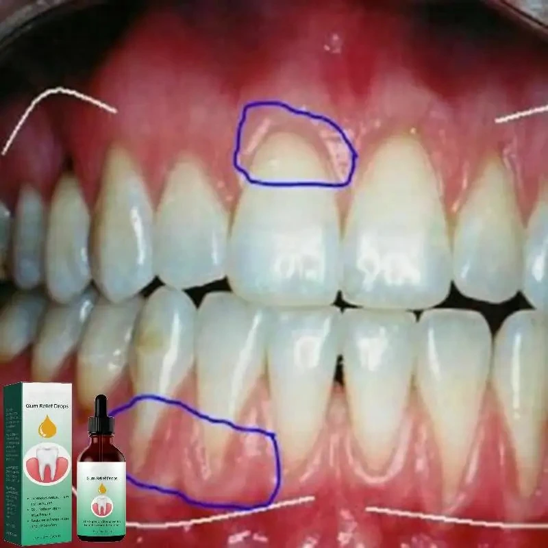 잇몸 수리 방울, 잇몸 붓기 완화, 잇몸 청소 관리,  - Teeth Whitening Paste 리뷰 및 가격