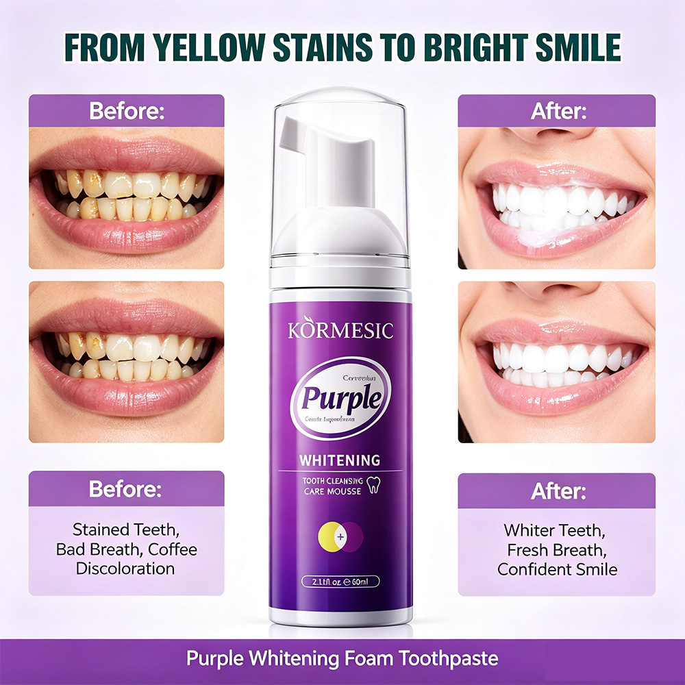 퍼플 화이트닝 치아 무스 폼 V34 컬러 코렉터 커피/ - Teeth Whitening Crest 리뷰 및 가격